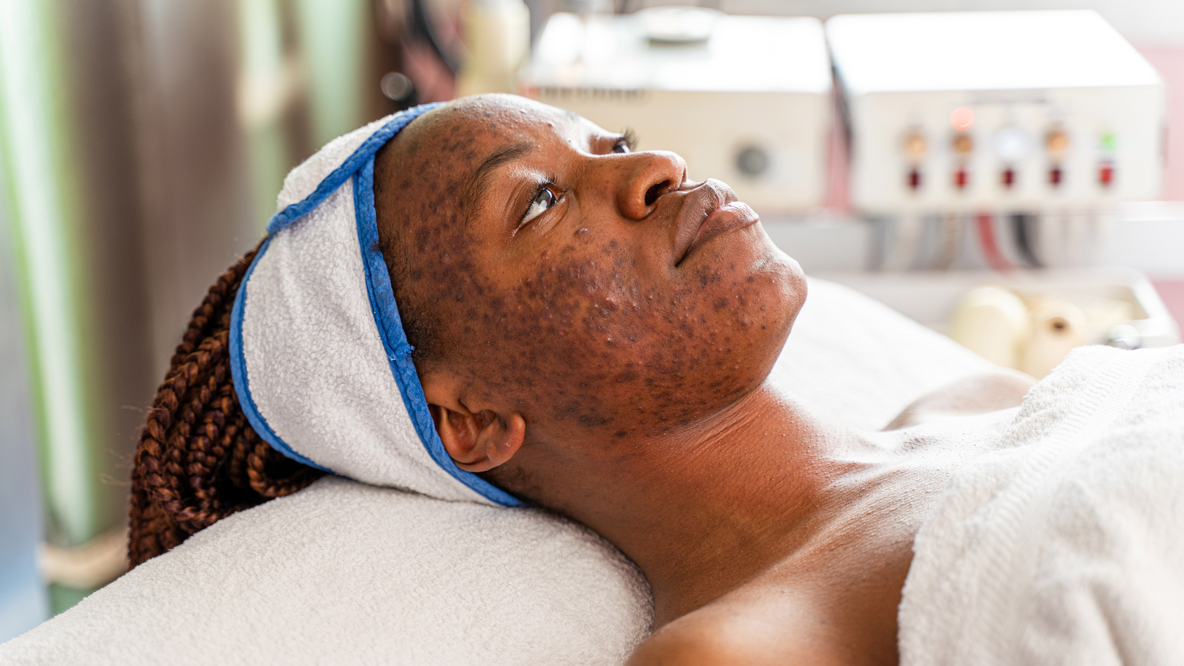 Holistic Skin Healing for Hyperpigmentation Fast: Your Guide to Clearer Skin
