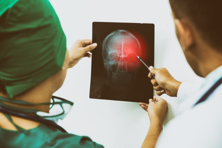 The Role Of Neurologists In Treating Traumatic Brain Injuries