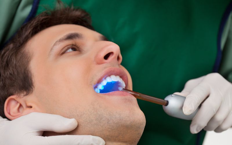 What Is Tooth Bonding? A Dentist’s Guide