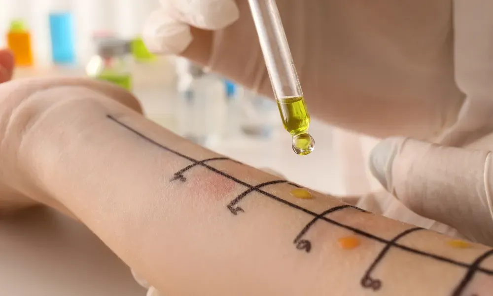 Allergist’s Perspective On Living With Multiple Allergies