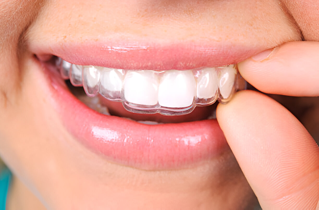 Achieving A Healthy Smile: The Role Of General Dentistry In Cosmetic Outcomes