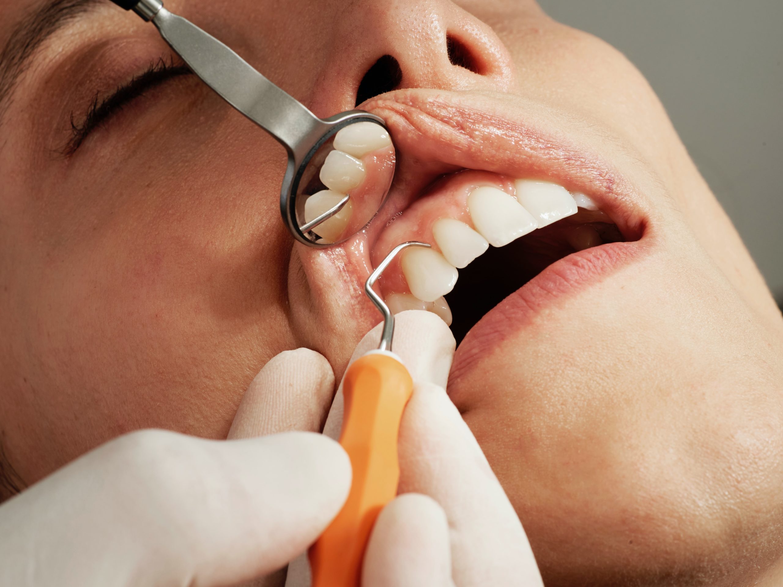 Innovative Treatments Offered by Today’s Periodontists